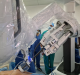 Regina Elena: dal polmone al mediastino, guida l’era del robot single port un solo foro per operare i pazienti più fragili